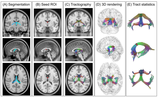 Cerebral Cortex: Professor Xu Haibo's Team at Wuhan University Applies 5.0 T Ultra-High-Resolution Diffusion Imaging to Reveal Lifelong Development Trajectories of the Human Fornix