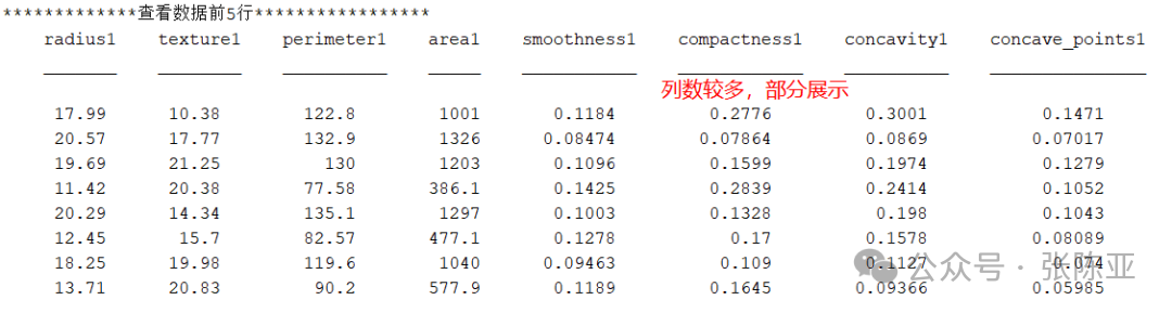 Application of SVM Support Vector Machine for Breast Cancer Classification Based on MATLAB