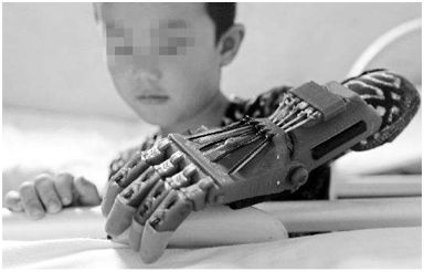 Can 3D Printing Cure Paralysis? A Two-Year Wait Finally Unleashed