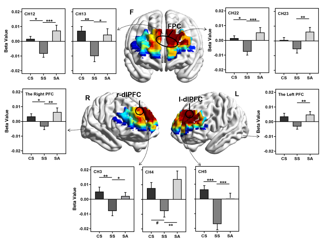 Professor Duan Haijun's Team Reveals the Neural Mechanism of tDCS Intervention in Improving Stress-Induced Creativity Impairment in Cerebral Cortex