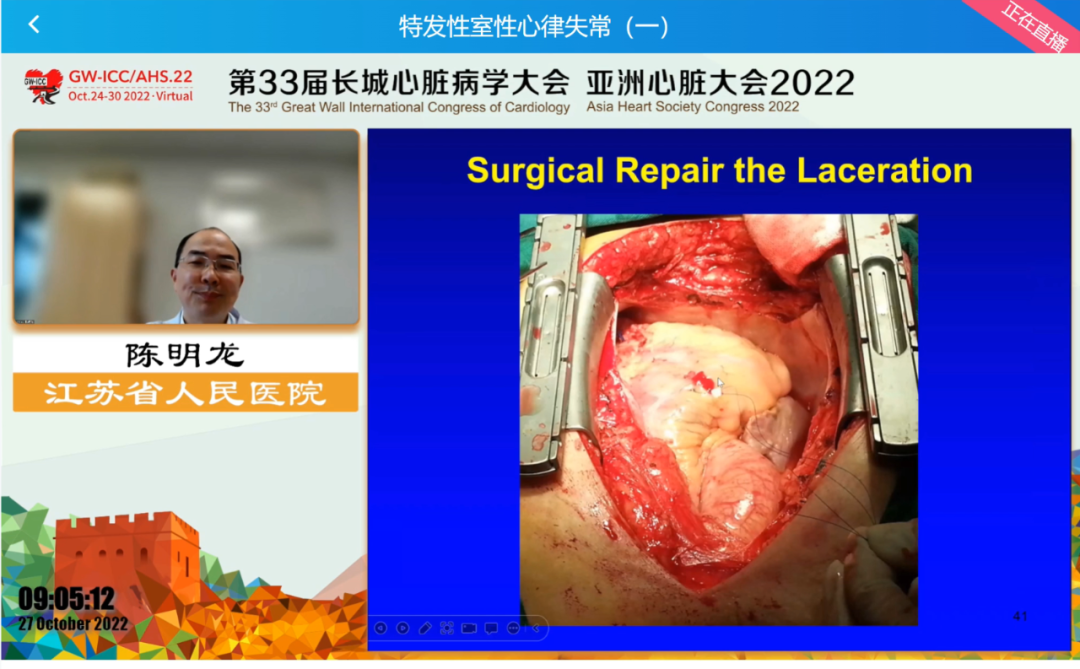 GW-ICC Report | Ventricular Arrhythmia Forum: Overcoming Challenges in Electrophysiological Technology