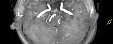 Case Study: Is ADC Reliable?