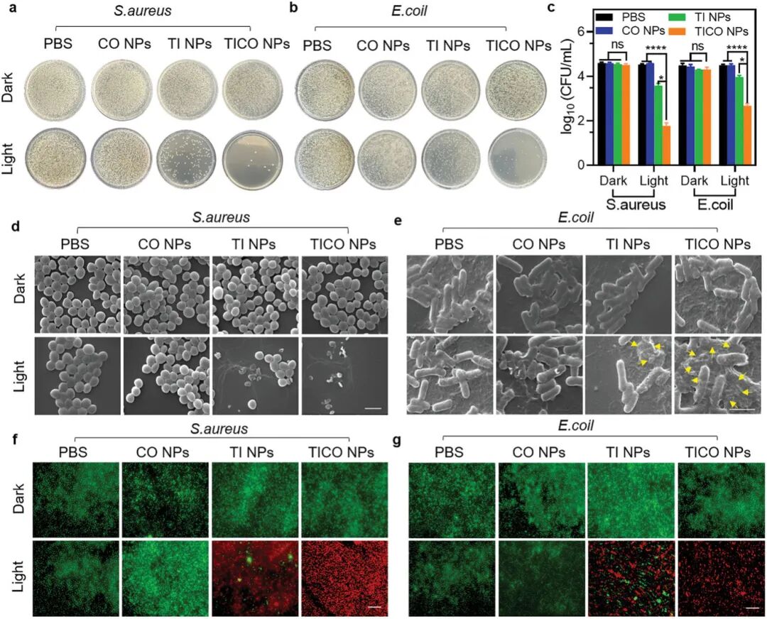 Bacterial Microenvironment-Responsive Microneedle Patches for Real-Time Monitoring and Synergistic Eradication of Infection