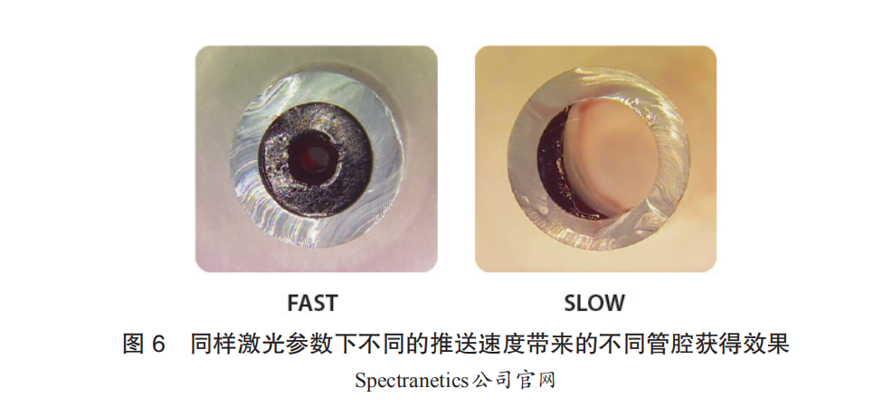 Cardiac Pacemakers and Ablation Devices