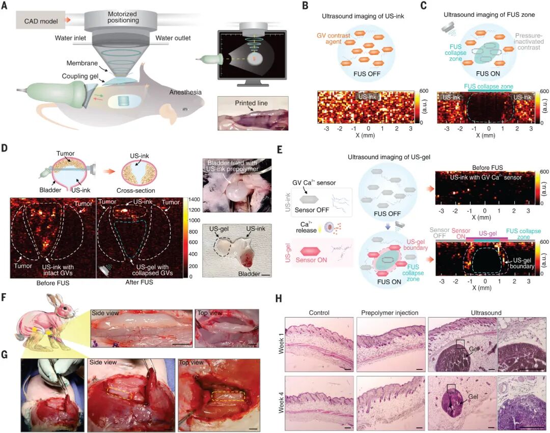 Ultrasound 3D Printing Enables Non-Invasive Surgery! Research Shows: Ultrasound-Guided In Vivo Acoustic Printing Technology Achieves High-Resolution Biological Structure Printing!