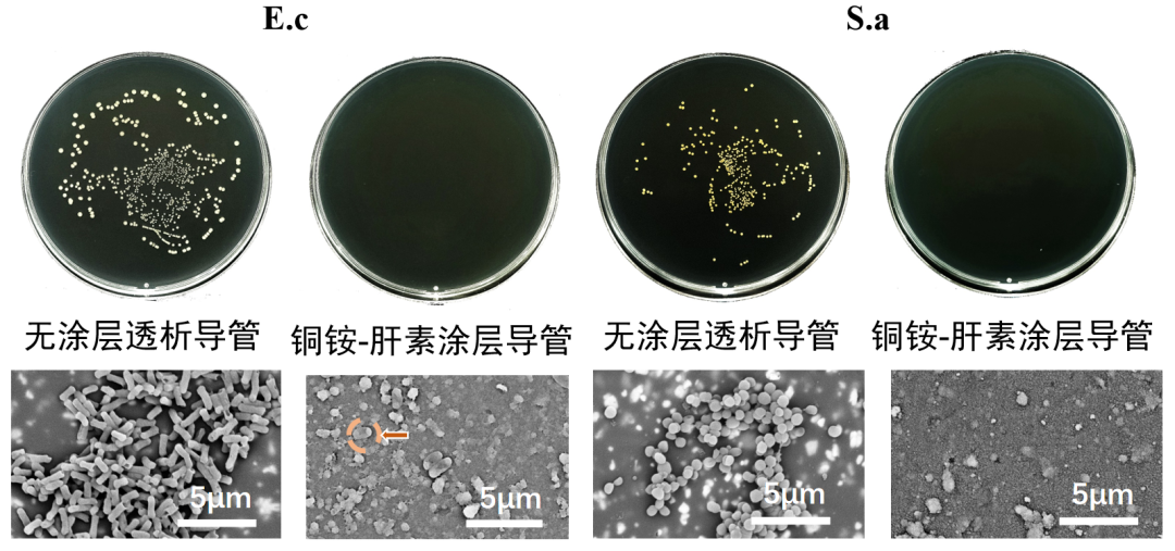 Professor Zhang Ling: Advances and Breakthroughs in Severe Blood Purification Technology