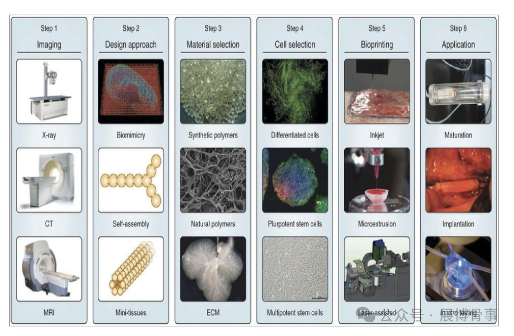 Innovative Solutions for Intervertebral Disc Degeneration: Breakthroughs in 3D Bioprinting by a South Korean Team