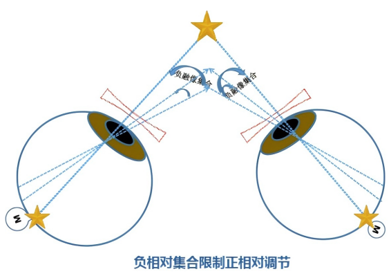 The Relationship Between Accommodation and Convergence: CA/C and AC/A and Their Examination Methods