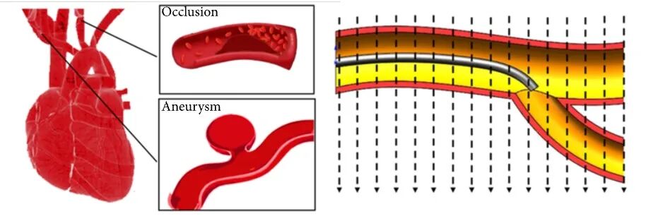 Beijing Institute of Technology Team Magnetizes Microrobots to Simulate Parkour in Blood Vessels and Manipulate Microscopic Objects