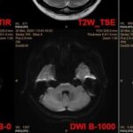 Case Study: Is ADC Reliable?