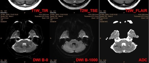 Case Study: Is ADC Reliable?