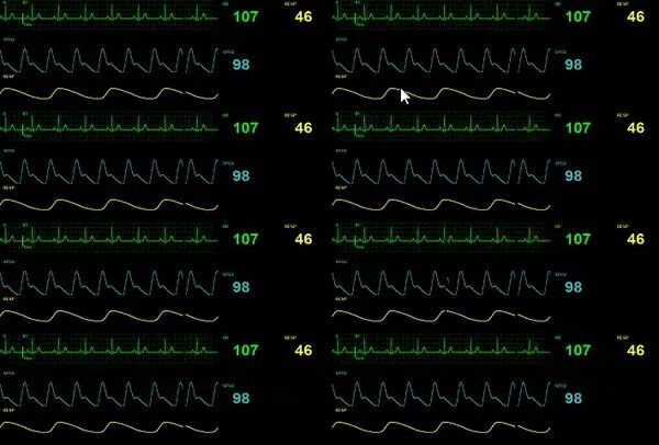 The Increasing Use of C++ in Embedded Linux Development