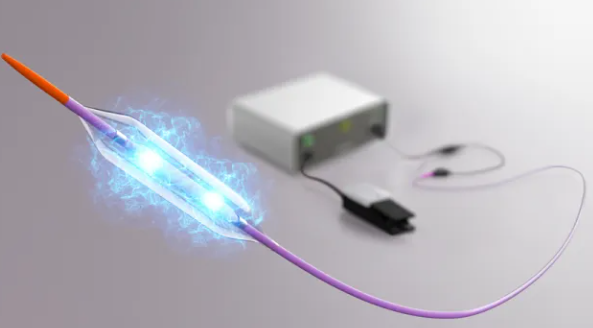 Intravascular Shockwave Balloon Catheter: Key Shockwave Patent Invalidated, Is a Spring for Domestic Devices Approaching?