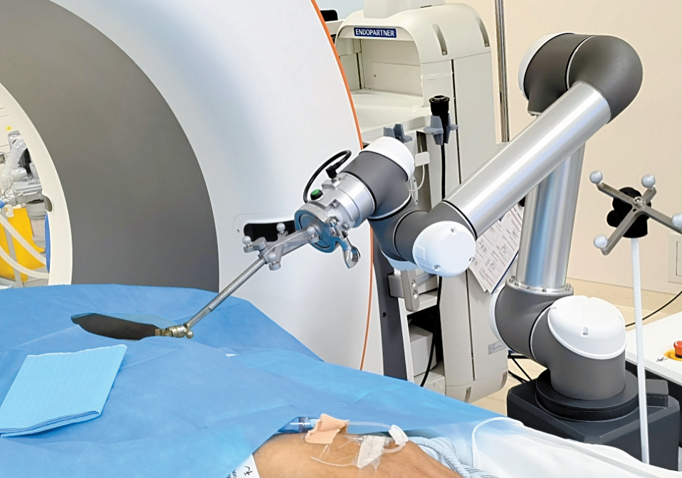 Doctor, Did AI Robots Cure My Lung Nodules?