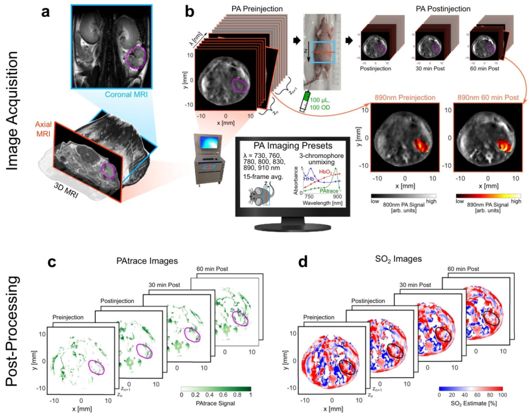 Nature Sub-Journal: Photoacoustic Imaging Technology for Precise Visualization of Tumor Microenvironments