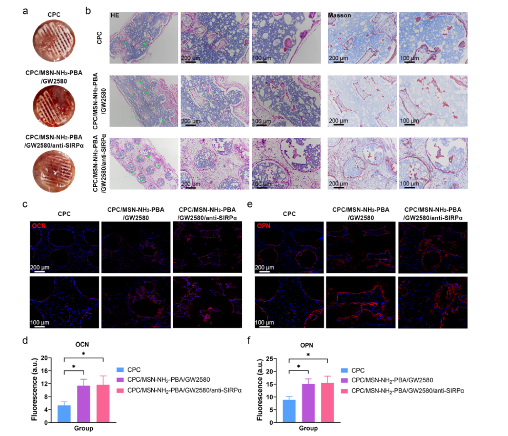 3D Printed Scaffolds Aid in Bone Defect Repair: A Study from Shanghai Jiao Tong University in Biomaterials