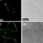 Self-Assembly of Alkynyl Platinum(II) Complexes and Their Application in Sialic Acid Detection and Differentiation of Cancer Cells from Normal Cells