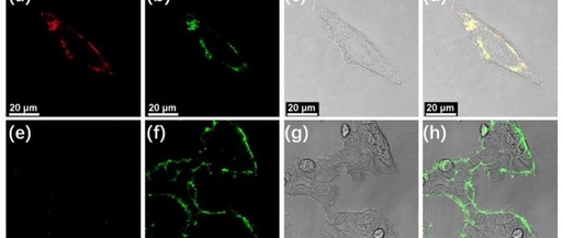 Self-Assembly of Alkynyl Platinum(II) Complexes and Their Application in Sialic Acid Detection and Differentiation of Cancer Cells from Normal Cells