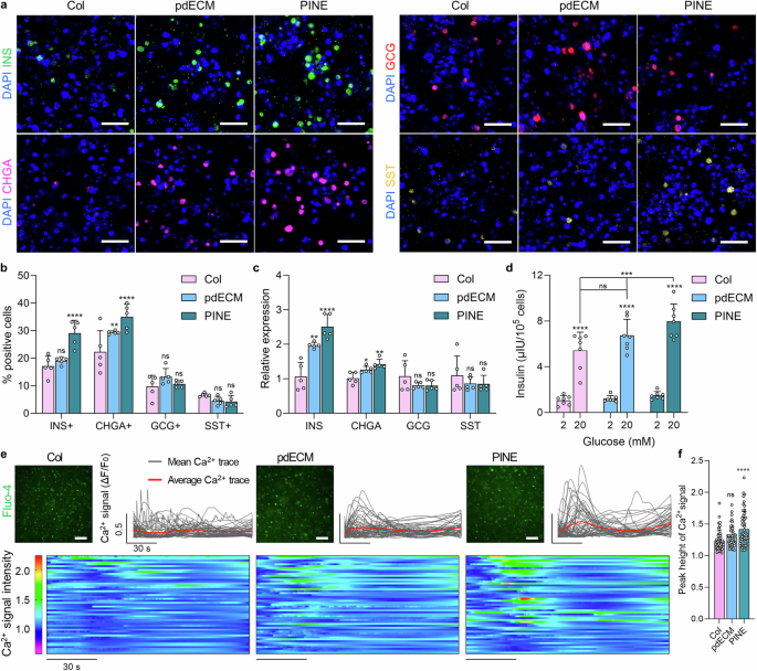 3D Printing of Islets: Can Printed Islets Treat Diabetes? Research Shows That Constructing Islet-Specific Microenvironments Through Bioprinting Technology Can Enhance Insulin Secretion!