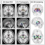Cerebral Cortex: Professor Xu Haibo's Team at Wuhan University Applies 5.0 T Ultra-High-Resolution Diffusion Imaging to Reveal Lifelong Development Trajectories of the Human Fornix
