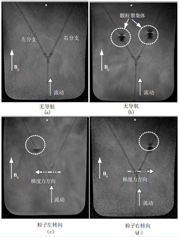 Cutting-Edge Collaboration: Southern Airlines and Montreal Research Team Launch DFN-D System Driven by Piezoelectric Robots for MRI Imaging, Aiming to Address MRI Treatment Challenges!