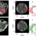 Nature Sub-Journal: Photoacoustic Imaging Technology for Precise Visualization of Tumor Microenvironments