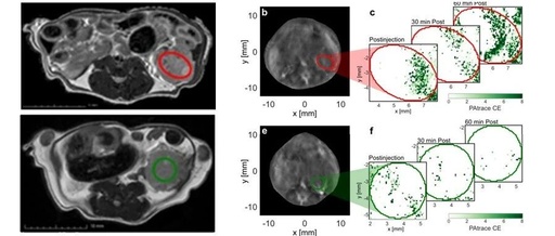 Nature Sub-Journal: Photoacoustic Imaging Technology for Precise Visualization of Tumor Microenvironments