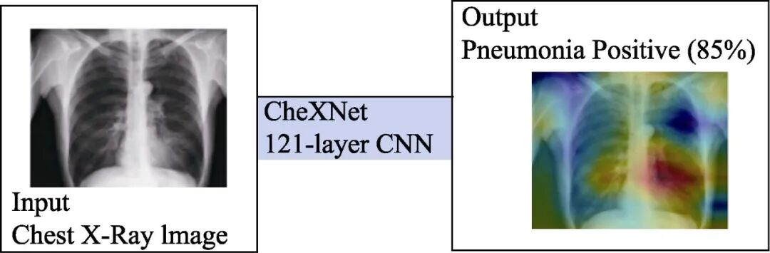Design and Implementation of a Computer-Aided Diagnosis System Based on Deep Learning in Embedded Systems