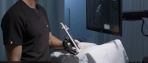 World's First Clinical Application! Breakthrough in Ultrasound + Handheld Robot for Kidney Stone Surgery