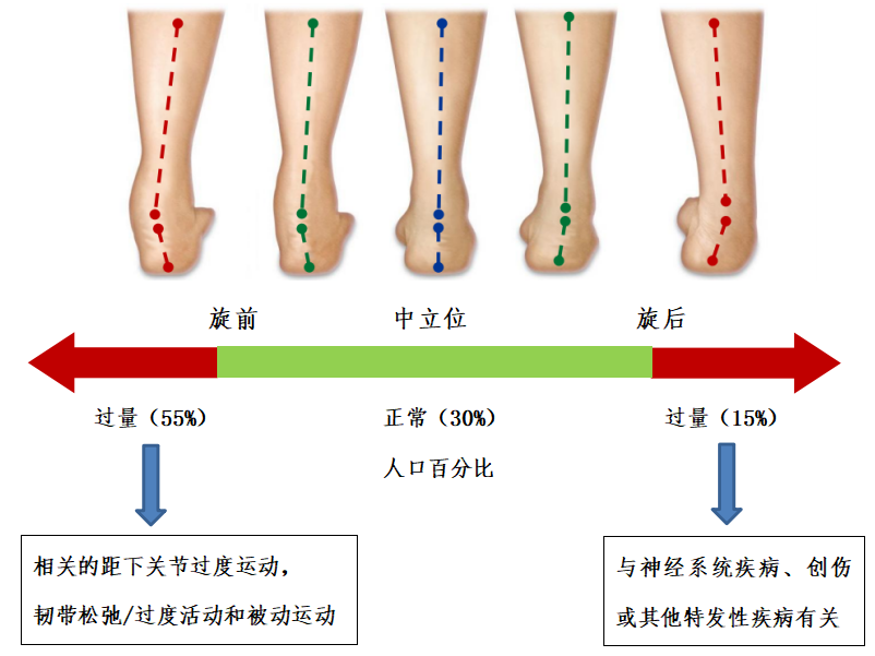 Customizing Foot Arches: The Revolution of 3D Printing