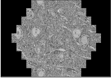 Discussion on Advanced Biomedical Imaging Equipment (Series 14: MultiSEM 505 Ultra-High-Throughput Multi-Beam Field Emission Scanning Electron Microscope)