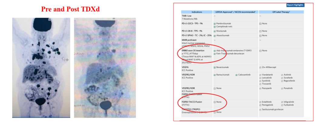 Biomarkers for ADCs: IHC and Beyond