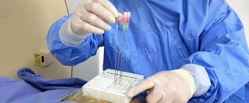 Minimally Invasive Tumor Techniques Series - 3D Printed Coplanar Template-Assisted Radioactive Particle Implantation