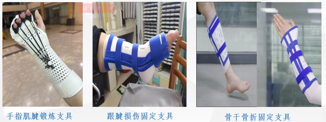 The Power of 3D Printed Orthopedic Braces