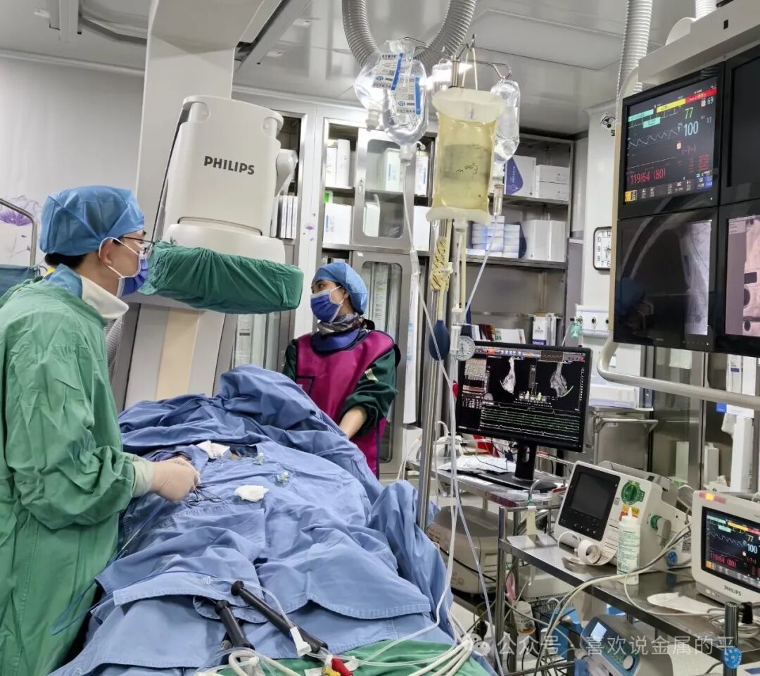 Can Smartwatch ECG Features Truly Warn of Atrial Fibrillation? Doctors Say: A Helper, Not the Gold Standard for Diagnosis