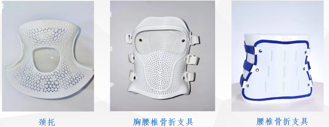The Power of 3D Printed Orthopedic Braces