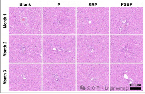 3D Printed Strontium-Doped Bioactive Glass/Polycaprolactone Scaffolds Enhance Immunomodulation and Bone Repair through Polydopamine Surface Modification