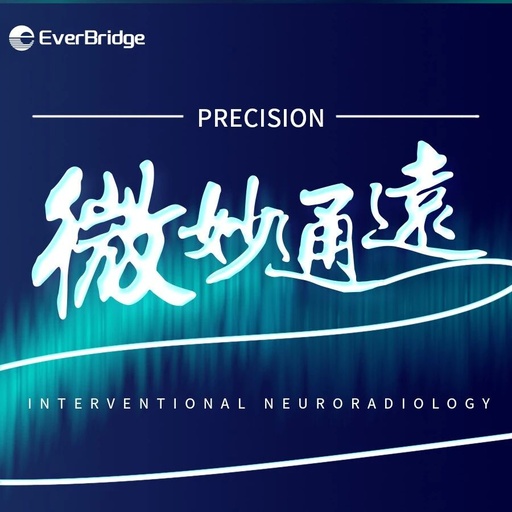 Application of the C-Balloon® Catheter Combined with the PathGuard® Umbrella for Endovascular Treatment of Floating Thrombus at the Carotid Artery Bifurcation