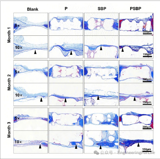 3D Printed Strontium-Doped Bioactive Glass/Polycaprolactone Scaffolds Enhance Immunomodulation and Bone Repair through Polydopamine Surface Modification