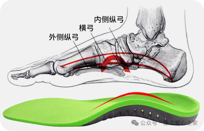 3D Printed Orthotic Insoles: Technology for Healthier Steps!