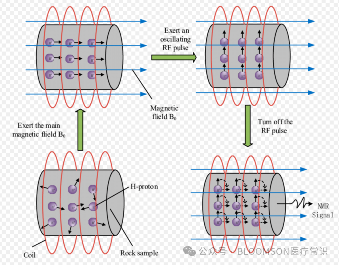 Overview of DWI and ADC Values in MRI