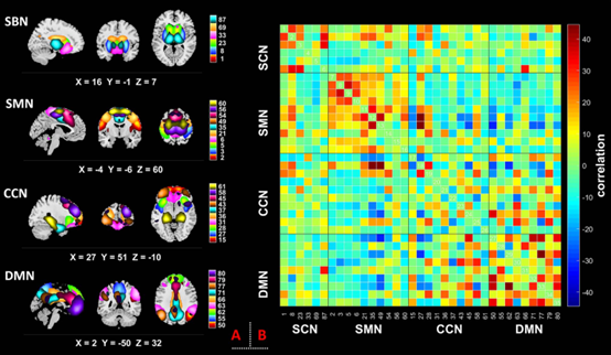 Subcortical-Cortical Functional Connectivity as a Potential Biomarker for Identifying Patients with Functional Dyspepsia