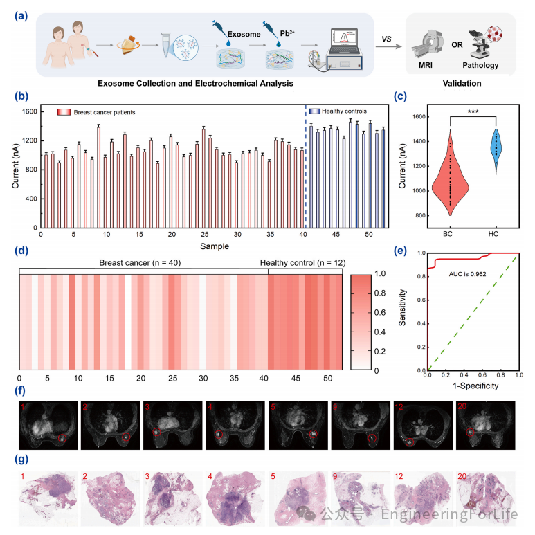 Exosome Aptamer Sensors for Staging Breast Cancer
