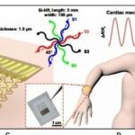 Electronic Tattoos for the Heart: Biodegradable Strain Sensors for Real-Time Detection of Myocardial Infarction