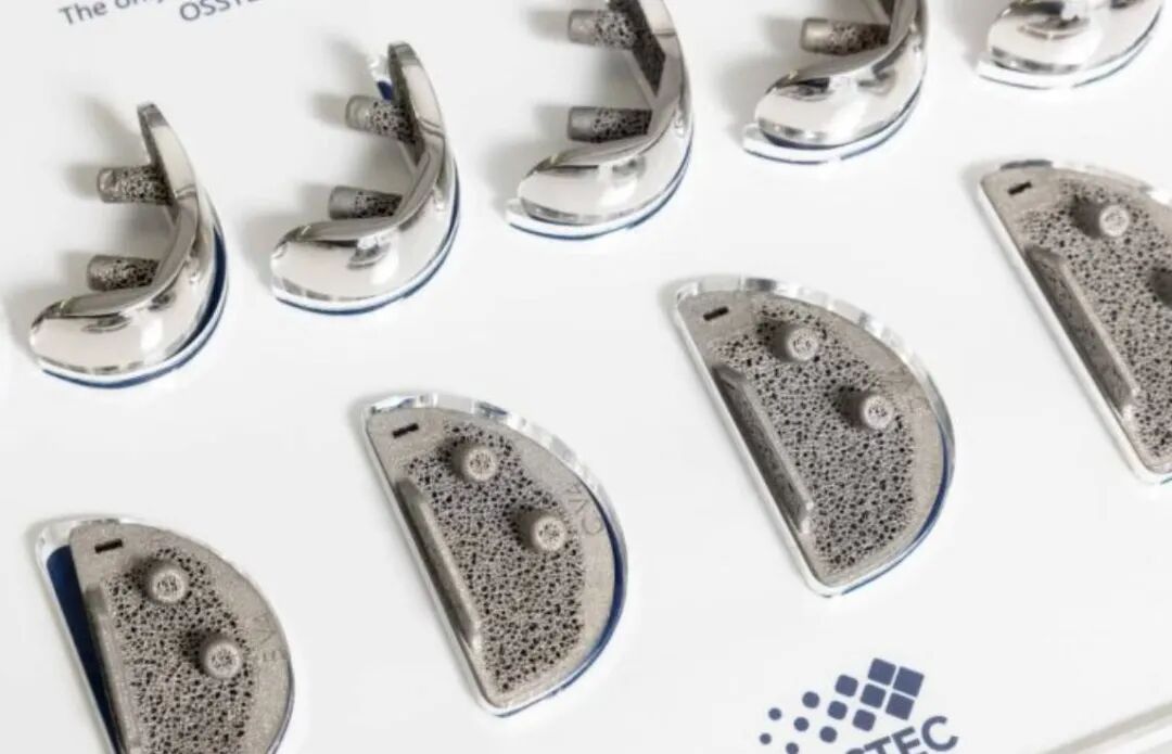 Metal 3D Printing of Orthopedic Implants Becomes an Investment Hotspot