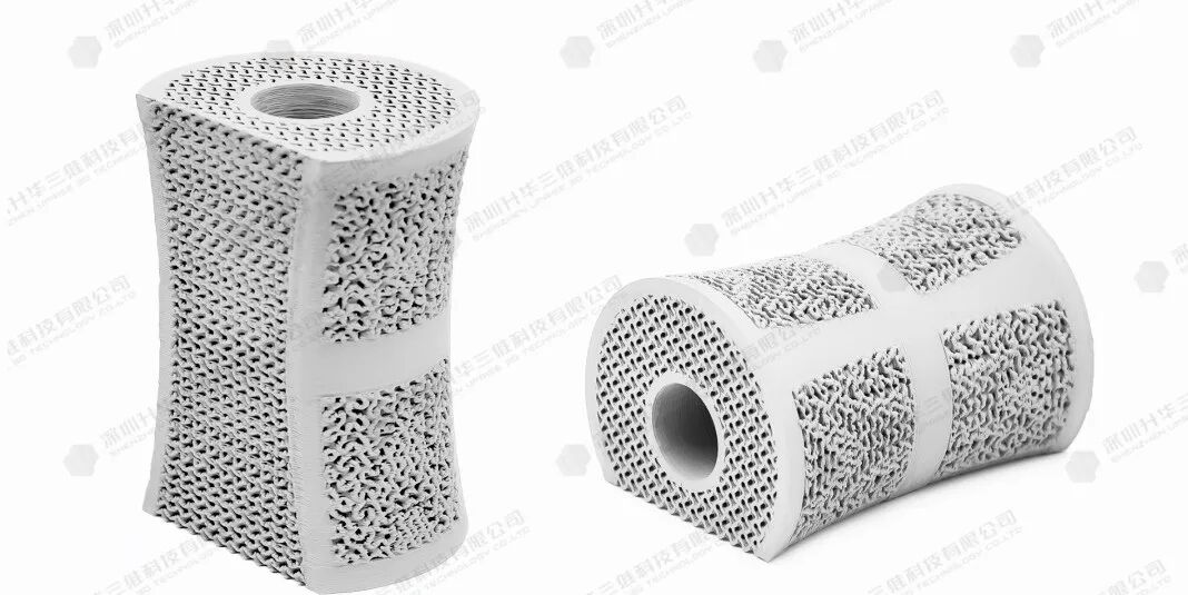 3D Printing of Silicon Nitride Ceramic Artificial Vertebrae: Achieving Personalized Customization of Biomimetic Bone Structures