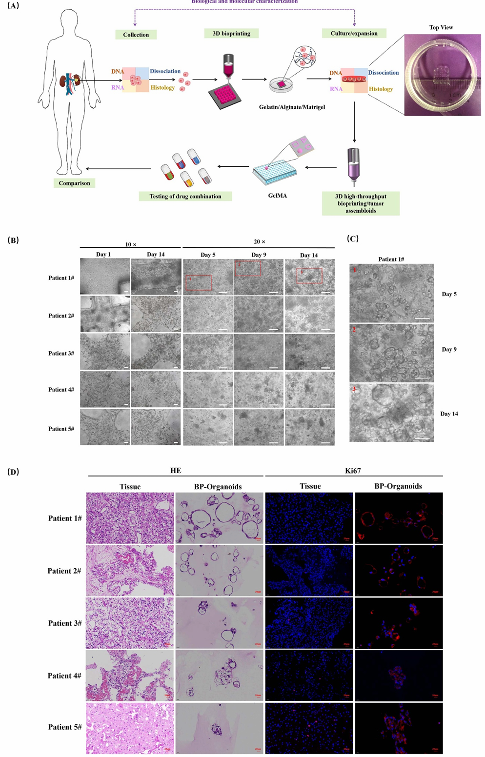 3D Bioprinting and Organoid Technology: Biofabrication of Multicellular Organoid Models to Recreate the Real Tumor Microenvironment