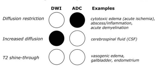 Overview of DWI and ADC Values in MRI