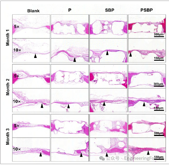 3D Printed Strontium-Doped Bioactive Glass/Polycaprolactone Scaffolds Enhance Immunomodulation and Bone Repair through Polydopamine Surface Modification