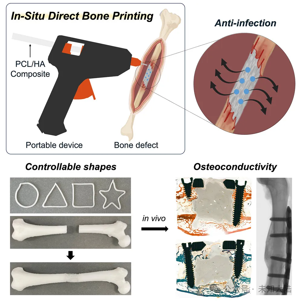 Researchers Develop Improved Glue Gun for 3D Printing Bone Scaffolds